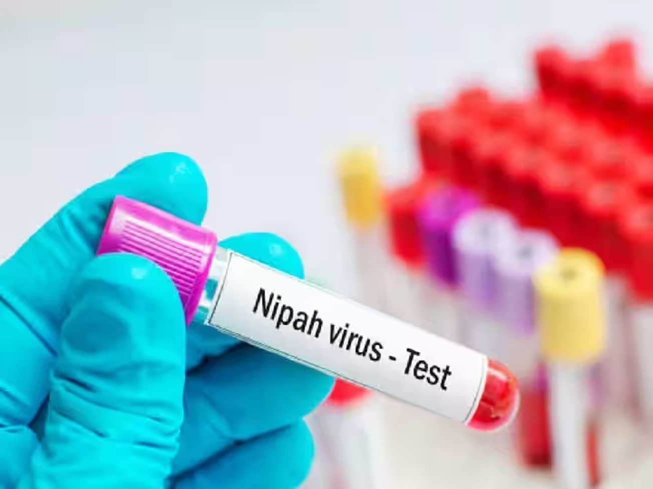 Nipah Virus - નિપાહ વાયરસ કોરોના કરતા 20 ગણો વધુ ખતરનાક છે.