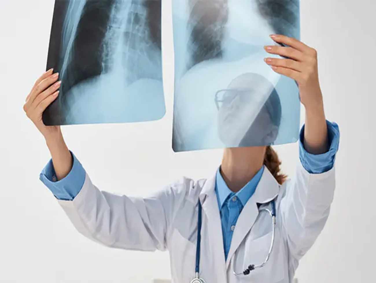 Lung patients increase in Gujarat : પ્રદુષણમાં વધારો થતાં ફેફસાંના દર્દી વઘ્યા : અમદાવાદમાં 32, ગુજરાતમાં 38 ટકા વધારો