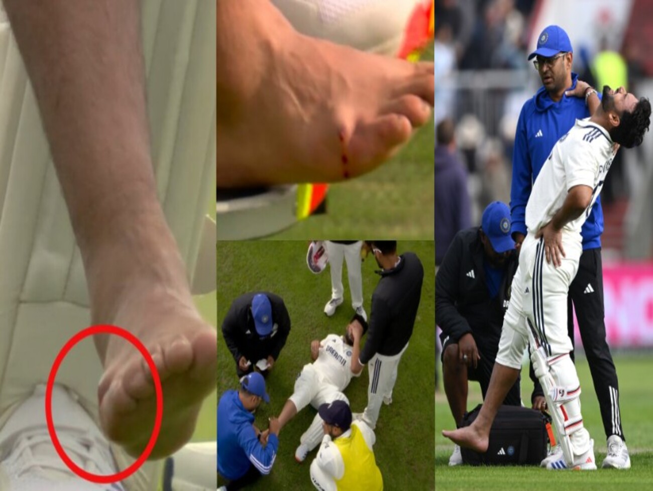 રિષભ પંતની ક્યારે થશે વાપસી? ઇજા અંગે સોશિયલ મીડિયા પર રિષભે પોતે  આપી અપડેટ