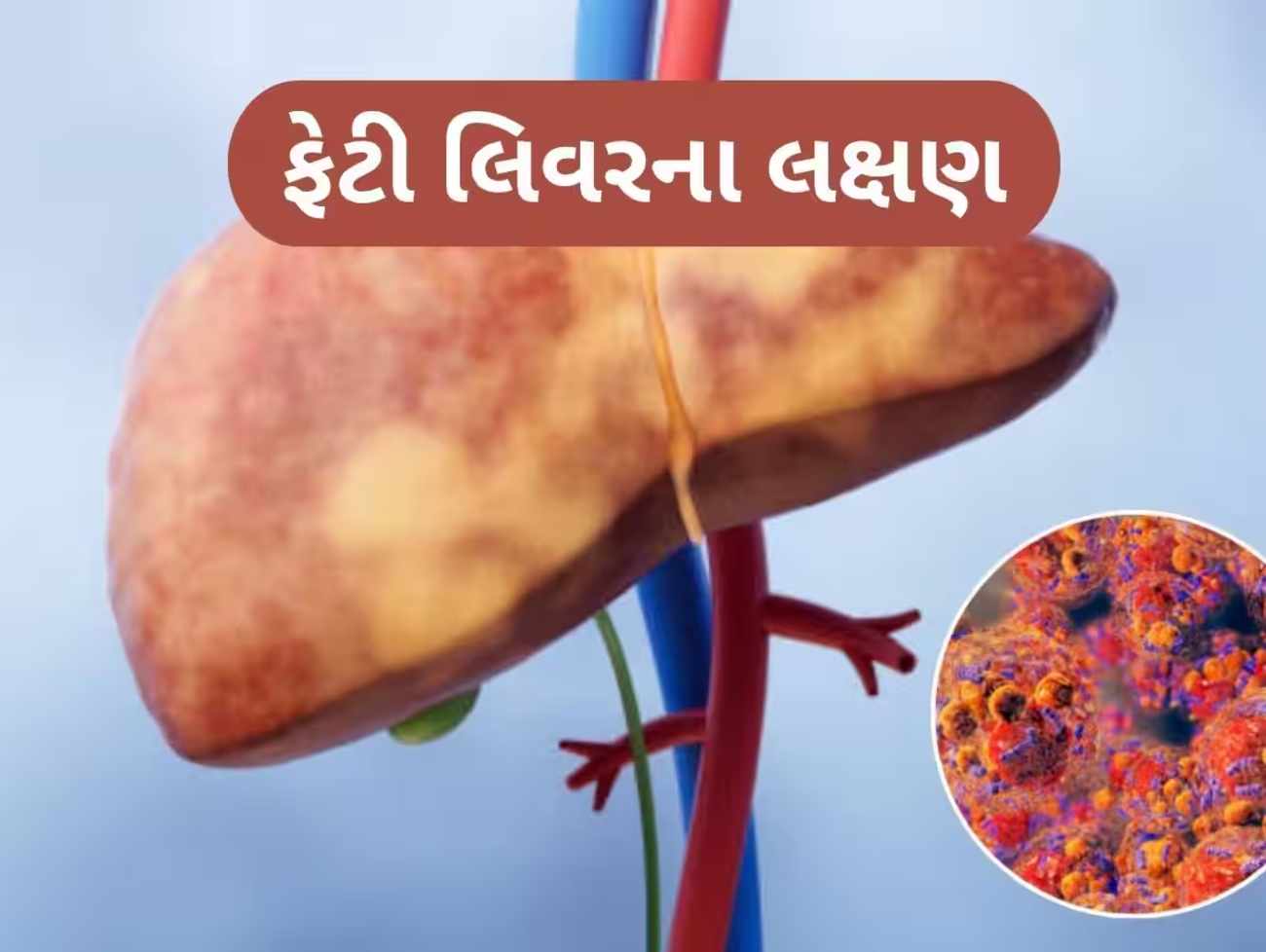 ફેટી લિવરને કારણે શરીરના આ ભાગમાં થાય છે દુખાવો, સામાન્ય લક્ષણ સમજી નજરઅંદાજ ન કરો