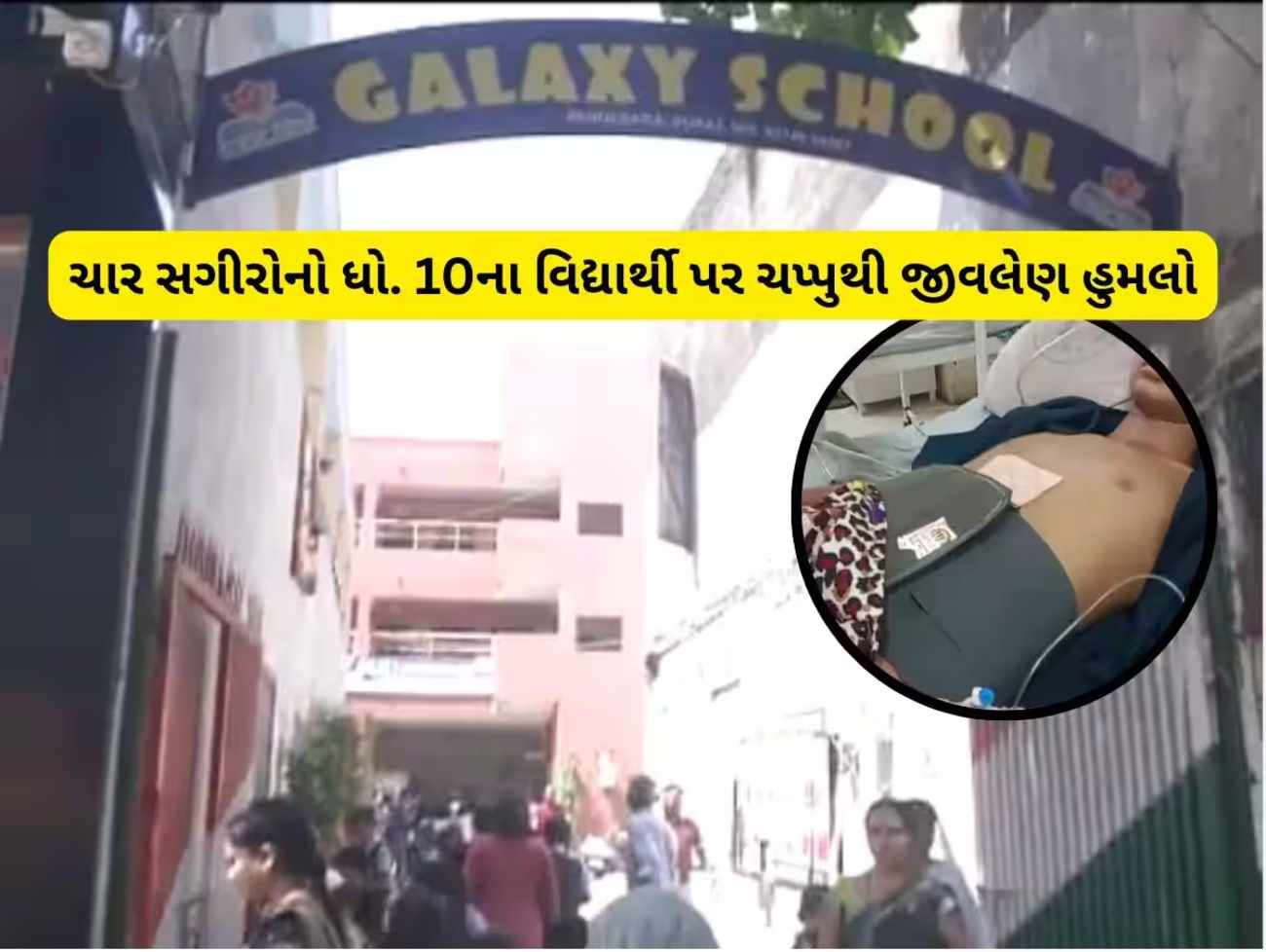 સુરતની શાળામાં વિદ્યાર્થી પર હુમલો : 4 વિદ્યાર્થીઓ બોર્ડના સ્ટુડન્ટ પર તૂટી પડ્યા, ચાકુ ઓનલાઈન મંગાવ્યું